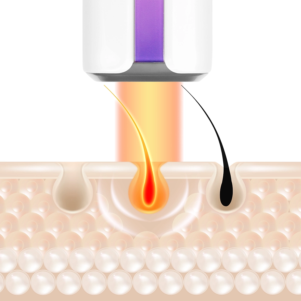  Máy triệt lông Yamaguchi IPL Hair Removal